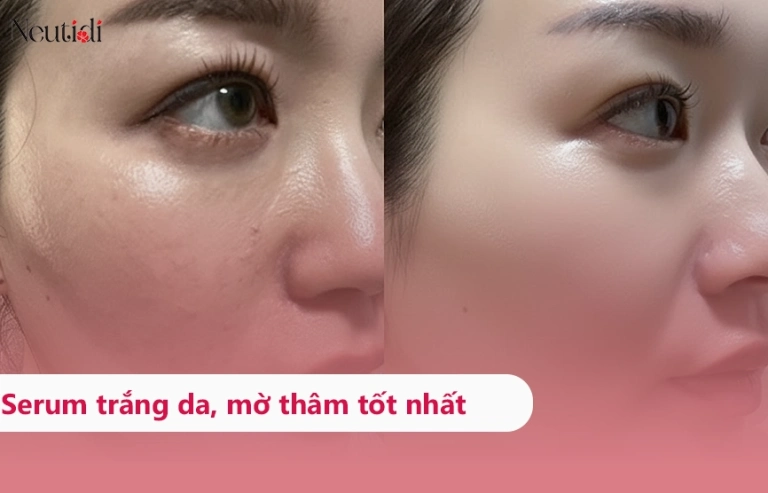 Khám Phá 10 Serum Trắng Da Hiệu Quả Nhất 2026 Giá Mềm