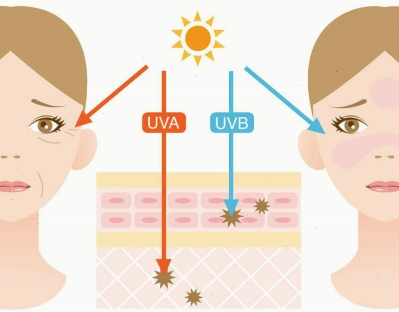 Tác động của ánh nắng mặt trời và tia UV gây ra các đốm nâu sạm trên da mặt